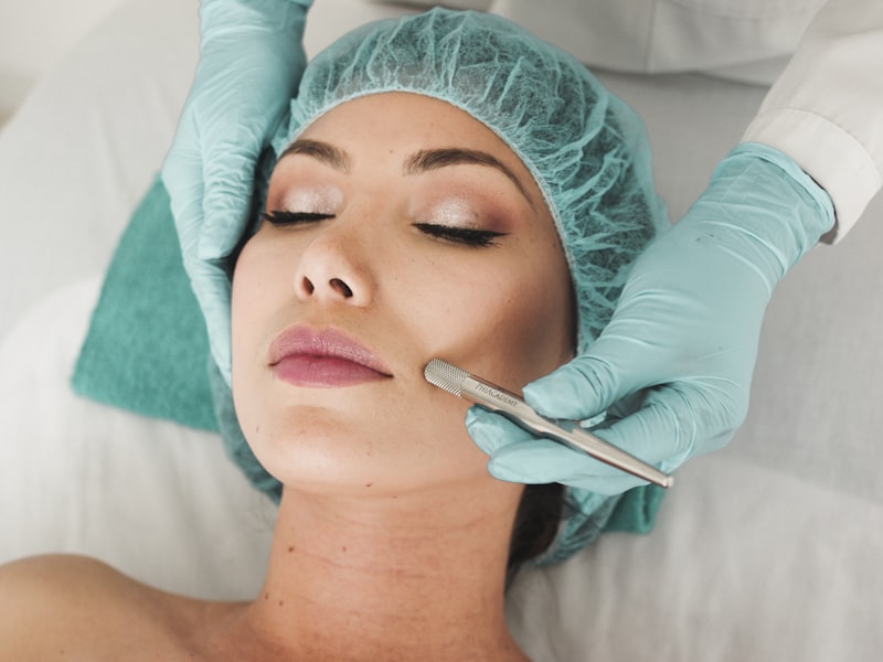 Radiofrecuencia facial